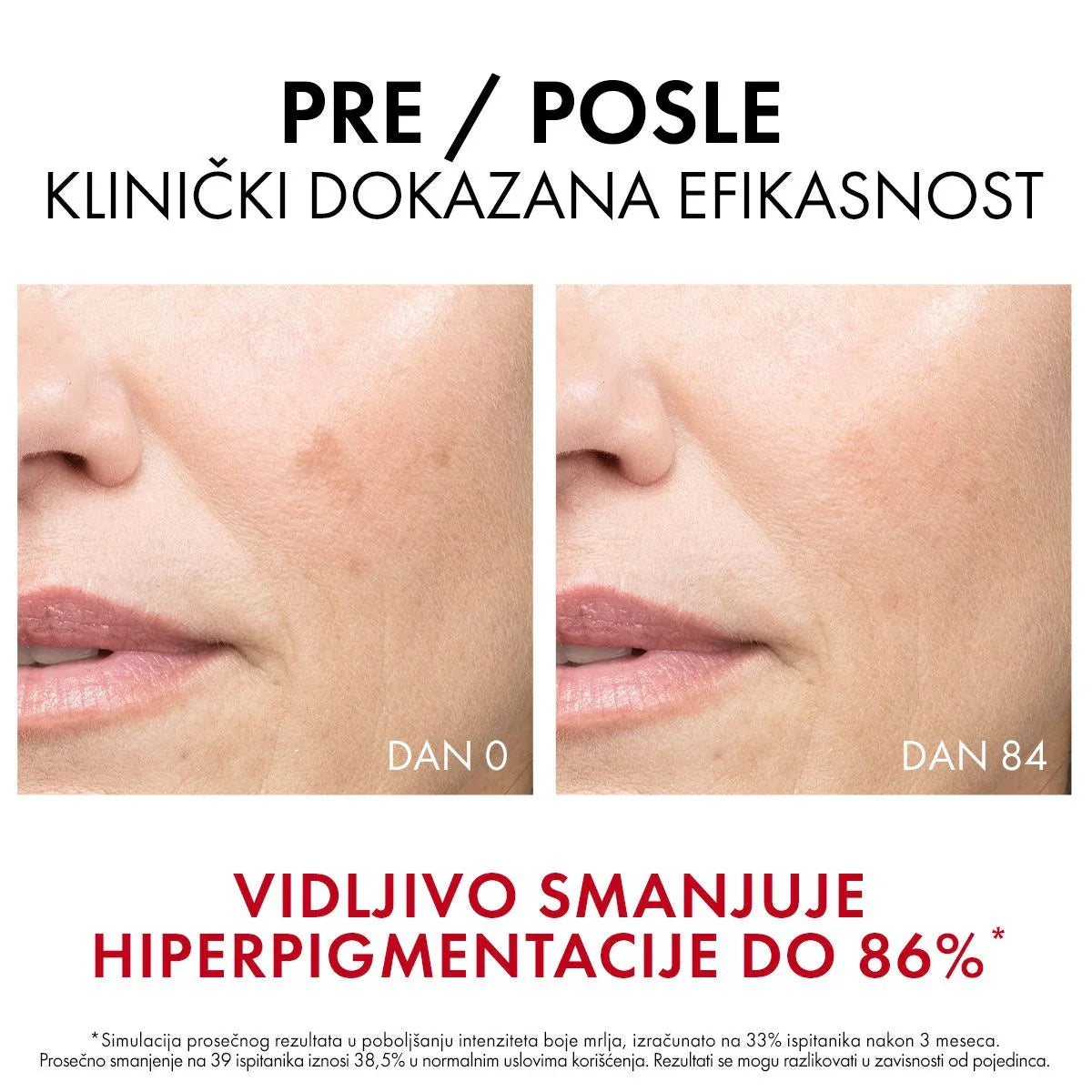 Vichy liftactiv pigment specialist B3 serum protiv hiperpigmentacijskih fleka, 30 ml