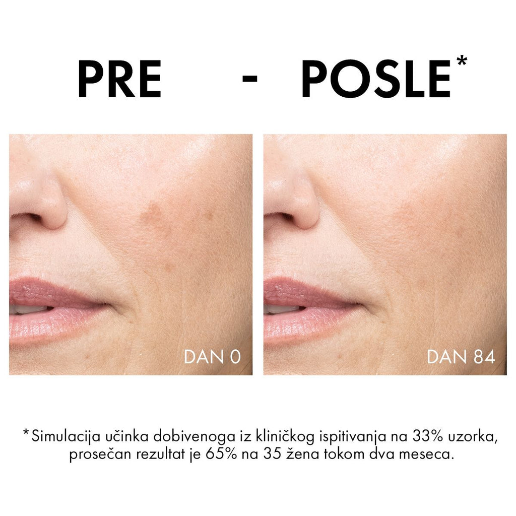 Vichy Liftactiv B3 krema protiv hiperpigmentacijskih fleka i bora SPF 50, 50ml
