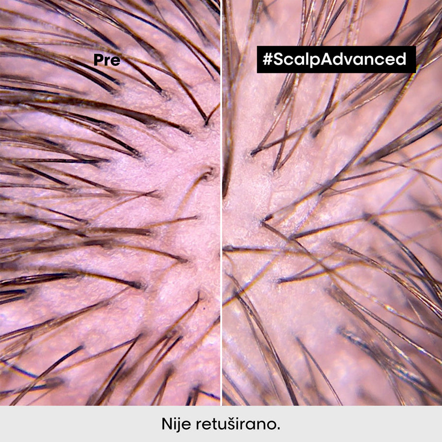 L'Oréal Professionnel Scalp Advanced šampon za osetljiv skalp 300ml