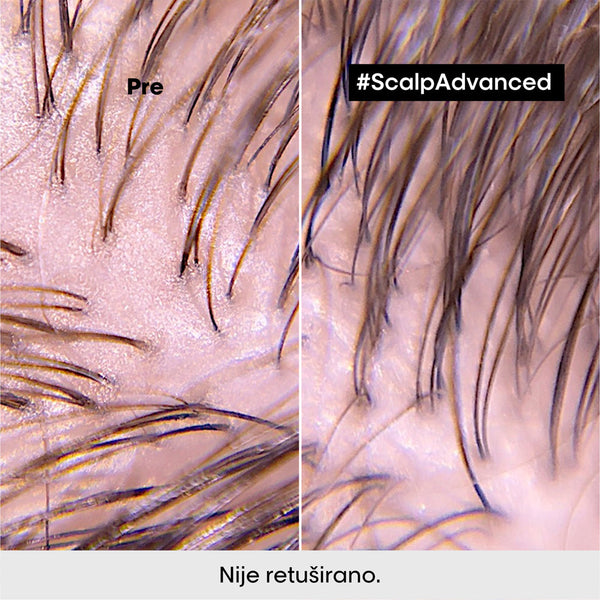 L'Oréal Professionnel Scalp Advanced šampon za masan skalp 300ml