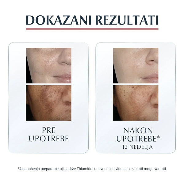 Eucerin Anti-Pigment serum  30ml