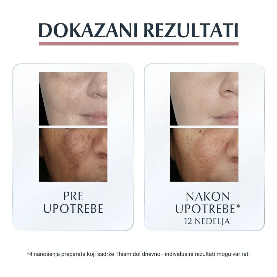 Eucerin Anti-Pigment serum  30ml