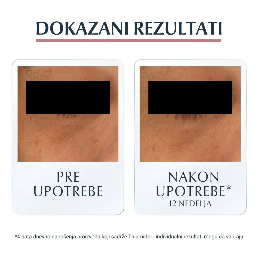 Eucerin Anti-Pigment Krema za tamne kolutove oko očiju 15ml