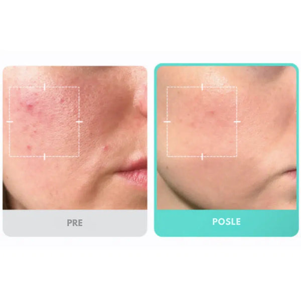 Medicube Azelaic Acid 16 BB Soothing Serum