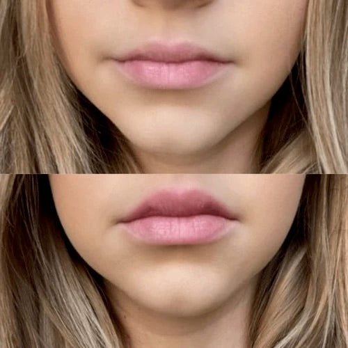 Lipgasm Lip Plumper