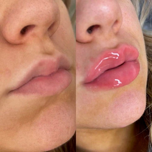 Lipgasm Lip Plumper