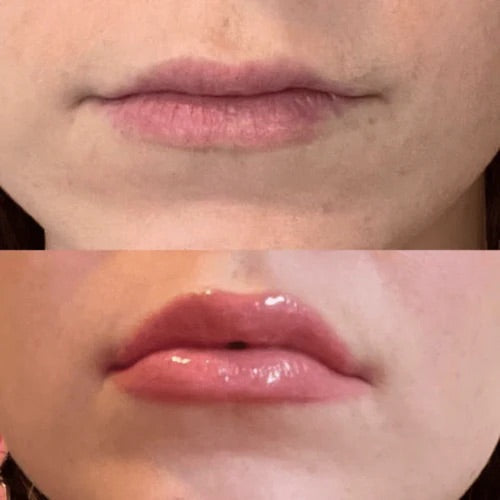 Lipgasm Lip Plumper