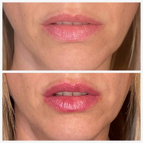 Lipgasm Lip Plumper