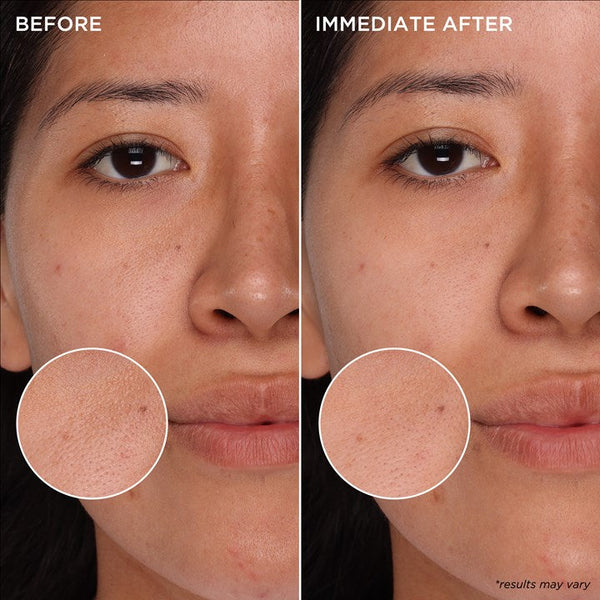 Benefit The POREfessional Deep Retreat