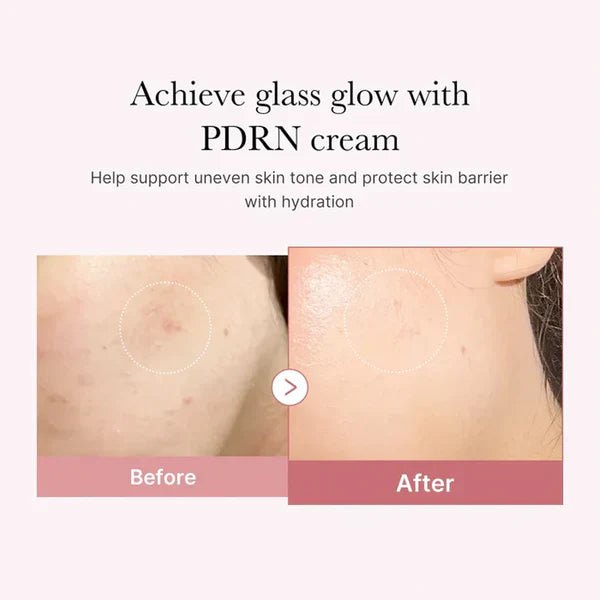 Medicube PDRN Pink Hyaluronic Moisturizing Cream